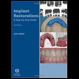 Implant Restorations Step by Step Guide