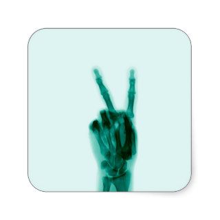 X Ray of Hand Doing Peace Sign Stickers