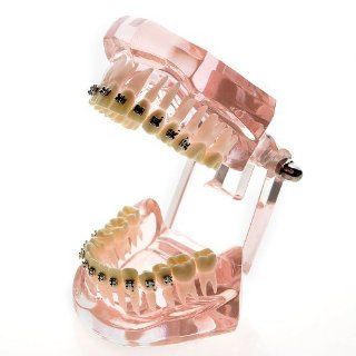 Generic Dental Orthodontics Study Teaching Model with 20 Pcs Metal Orthodontic Brackets Health & Personal Care