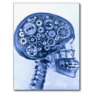 X ray of skull with gears postcards