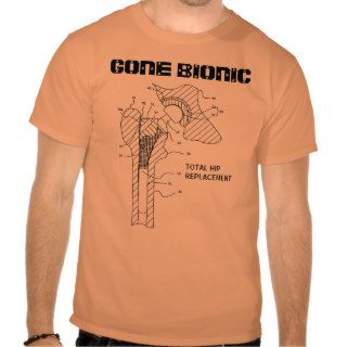 "GONE BIONIC" Hip Replacement t shirt