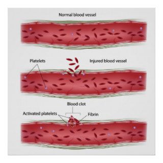 Blood clotting process Poster