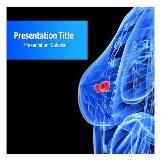 Breast Cancer Powerpoint Template   Breast Cancer Powerpoint (Ppt) Template Software