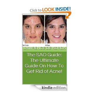 The SAO Guide The Ultimate Guide On How To Get Rid of Acne eBook Lawrence De Korda Kindle Store