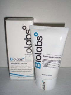 Biolabs Stretch Mark Concealer  Stretch Mark Prevention Products  Beauty