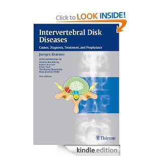Intervertebral Disk Diseases Causes, Diagnosis, Treatment and Prophylaxis eBook Juergen Kraemer Kindle Store
