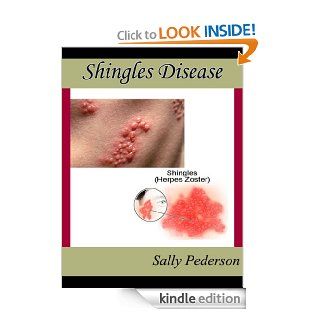 Shingles Disease   The Complete Guide   Everything you need to know about Shingles Disease;  from What Causes Shingles to Treatment for Shingles and everything in between. eBook Sally Pederson Kindle Store
