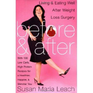 Before and After Living and Eating Well After Weight Loss Surgery Susan Maria Leach 9780060567224 Books