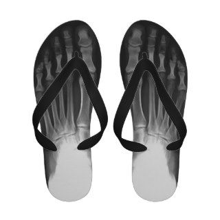 X rayed   Feet Flip Flops