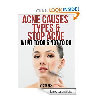 Acne Causes Types & Stop Acne  What to Do & Not to Do eBook Vic Taech Kindle Store