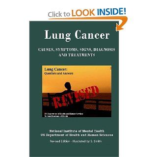 Lung Cancer Causes, Symptoms, Signs, Diagnosis, Treatments, Stages Of Lung Cancer   Revised Edition   Illustrated by S. Smith (9781469967240) Department of Health and Human Services, National Institutes of Health, National Cancer Institute, S. Smith Boo